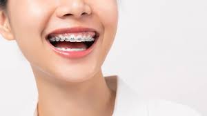 reduce swollen gums with braces
