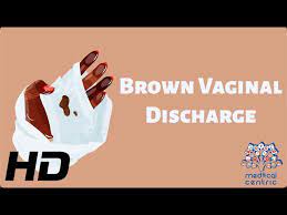 brown inal discharge everything you