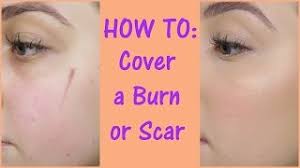 how to cover a scar with makeup you