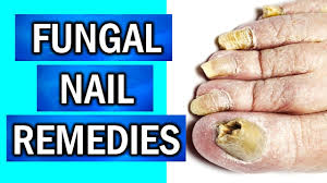 cure fungal nail infections