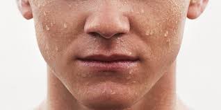 sunburned lips best treatments and