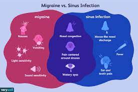 sinus headaches symptoms treatment
