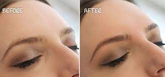 hd brows before and after treatment