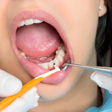 mouth disorders common mouth problems