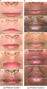 lip philtrum guides 1 a and 2 b are