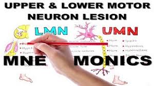 upper lower motor neuron lesions