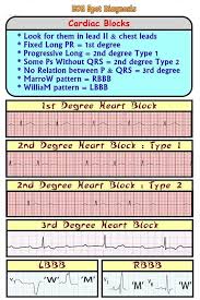 Ecg Ekg Spot Diagnosis Cardiac Rhythms Heart Blocks
