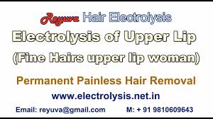 permanent painless hair removal of