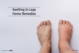 swelling in legs home remes by dr
