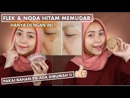 Check spelling or type a new query. Tips Menghilangkan Flek Hitam Noda Di Wajah Dengan Bahan Alami Murah Youtube