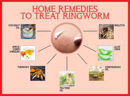 best home remes for ringworm femina in