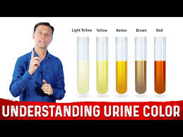 what urine color indicates about your