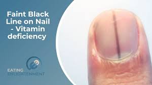 black line on nail vitamin deficiency