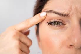 blepharoplasty or a brow lift