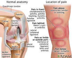 This diagram depicts knee diagram tendons. Knee Pain Medlineplus Medical Encyclopedia
