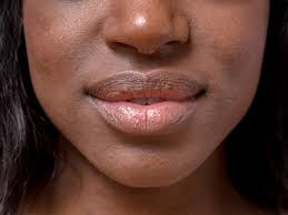 what causes lips to turn black
