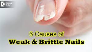 10 causes of weak brittle nails
