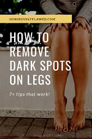 how to remove dark spots on legs 7