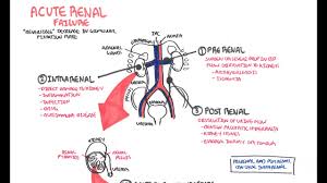 Acute Renal Failure