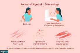 Miscarriage Or Period How To Tell The Difference