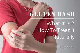 gluten rash early warning signs how