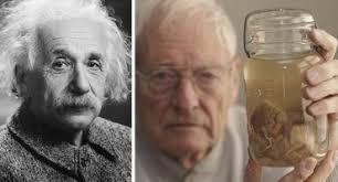 Albert einstein starb 1955 im alter von 76 jahren. Was Hat Man In Einsteins Gehirn Gefunden Quora