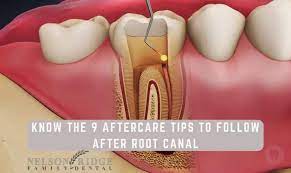 root c treatment