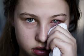 red eyelids symptoms causes treatments