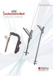 atn trochanteric fem nail