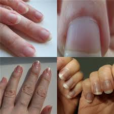 pictures nails and nail folds