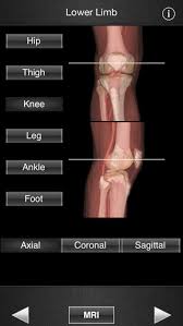 Knee joint anatomy is complex with muscles, ligaments, cartilage and tendons. Monster Anatomy Lower Limb Mobile App