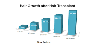 Maybe you would like to learn more about one of these? How To Prepare For Hair Transplant Surgery Hair Transplant And Hair Loss Blog Fchtc