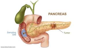 10 makanan yang bagus untuk kesehatan pankreas. Kanker Pankreas Penyakit Diam Yang Merenggut Nyawa Health Liputan6 Com