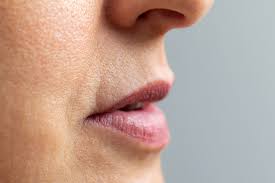 lip wrinkles how to get rid of lip