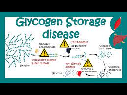 glycogen storage diseases gsd which