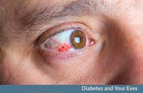 diabetes effects vision illinois