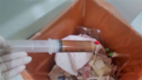 No Entry!" Hospitals Caught Dumping Human Fat from Surgeries en Masse | SBS ´º½º