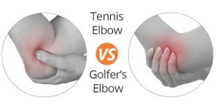 Tennis Elbow And Golfers Elbow Whats The Difference