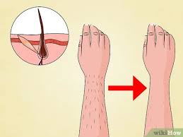 Can you get permanent laser hair removal. How To Get The Most Benefit From Laser Hair Removal 11 Steps