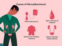 Microalbuminuria Symptoms Causes And Diagnosis