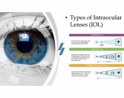 what is the best lens for your cataract