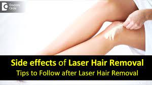 side effects after laser hair removal