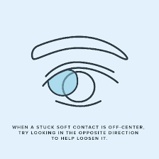 remove a contact lens stuck in your eye