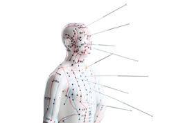 Acupuncture Needle Size Chart