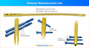 fem reconstruction nail uses sizes