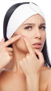 home remes to remove pimple marks