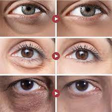eye cream retinol anti aging serum