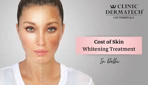 skin whitening treatment in delhi