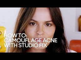 how to camouflage acne with studio fix