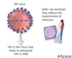 hiv aids information mount sinai